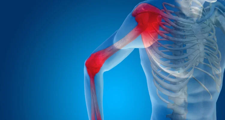 How Joint Injuries Affect Daily Life and Long-Term Function